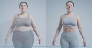The rise of Ozempic for weight loss